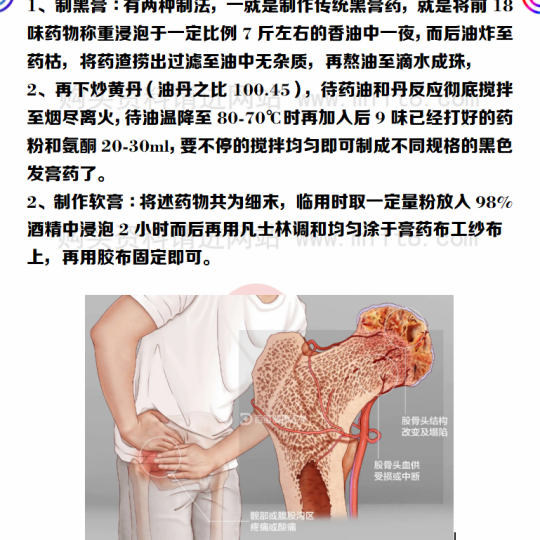 秘方堂提供股骨头坏死套装10.8元第4张-秘方堂